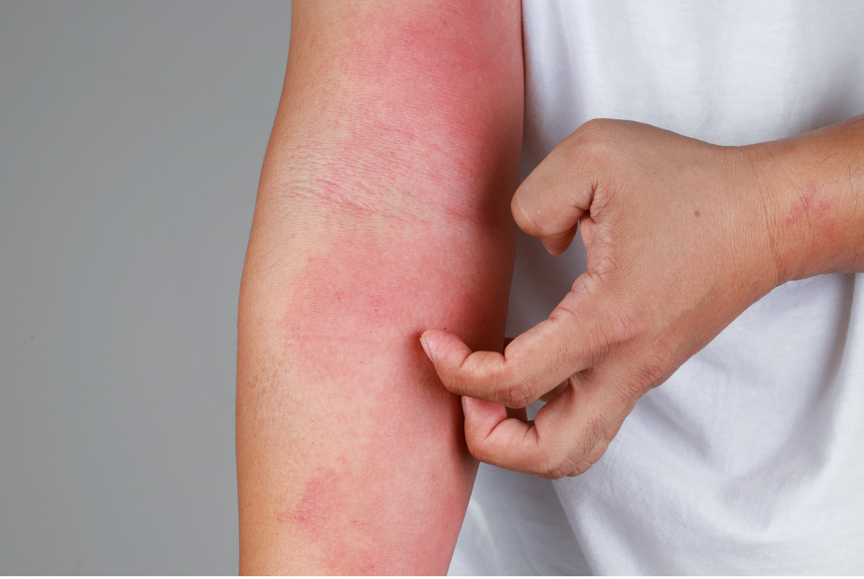A Guide to Avoiding Skin Irritation with Hair Removal Creams